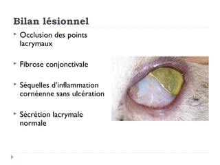 Bilan lésionnel
   Occlusion des points
    lacrymaux

   Fibrose conjonctivale

   Séquelles d’inflammation
    cornéenne sans ulcération

   Sécrétion lacrymale
    normale
 
