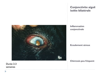 Conjonctivite aiguë
            isolée bilatérale




            Inflammation
            conjonctivale




            Ecoulement séreux




            Chémosis peu fréquent
Durée 2-3
semaines
 