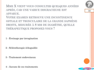 33
1 - Eveinage par invagination
2 - Sclérotherapie échoguidée
3 - Traitement endoveineux
4 - Aucune de ces traitements
MME X VIENT VOUS CONSULTER QUELQUES ANNÉES
APRÈS, CAR UNE VARICE DISGRACIEUSE EST
APPARUE.
VOTRE EXAMEN RETROUVE UNE INCONTINENCE
OSTIALE ET TRONCULAIRE DE LA GRANDE SAPHÈNE
DROITE, MESURÉE À 8 MM DE DIAMÈTRE, QUELLE
THÉRAPEUTIQUE PROPOSEZ-VOUS ?
 