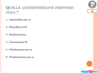 QUELLE ANTIBIOTHÉRAPIE PROPOSEZ-
VOUS ? 36
1 - Amoxicilline per os
2 - Pénicilline G IV
3 - Erythromycine
4 - Vancomycine IV
5 - Clindamycine per os
6 - Pristinamycine per os
 