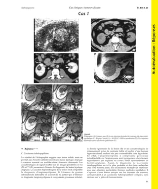 Cas cliniques tumeurs du rein | PDF