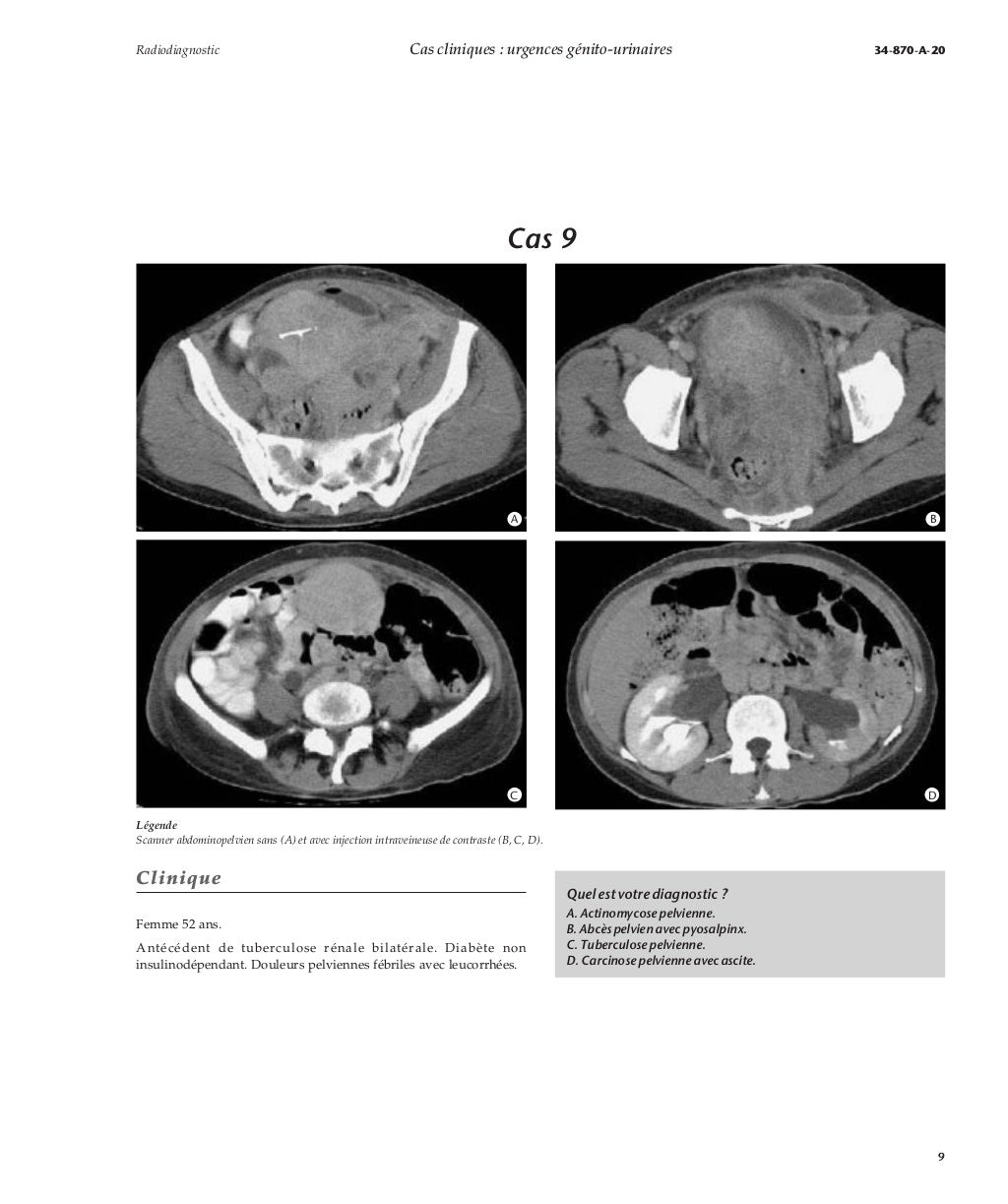 Cas cliniques urgences génito-urinaires
