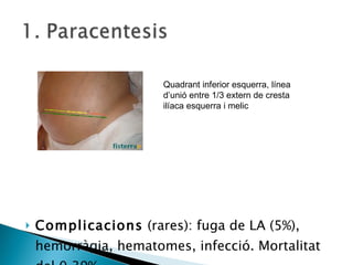 Complicacions  (rares): fuga de LA (5%), hemorràgia, hematomes, infecció. Mortalitat del 0.39%. Quadrant inferior esquerra, línea d’unió entre 1/3 extern de cresta ilíaca esquerra i melic 