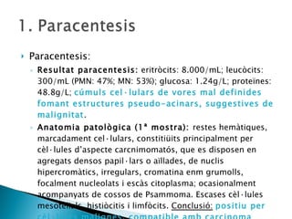 Paracentesis: Resultat paracentesis:  eritròcits: 8.000/mL; leucòcits: 300/mL (PMN: 47%; MN: 53%); glucosa: 1.24g/L; proteïnes: 48.8g/L;  cúmuls cel·lulars de vores mal definides fomant estructures pseudo-acinars, suggestives de malignitat . Anatomia patològica (1ª mostra):  restes hemàtiques, marcadament cel·lulars, constitiüits principalment per cèl·lules d’aspecte carcnimomatós, que es disposen en agregats densos papil·lars o aïllades, de nuclis hipercromàtics, irregulars, cromatina enm grumolls, focalment nucleolats i escàs citoplasma; ocasionalment acompanyats de cossos de Psammoma. Escases cèl·lules mesotelials, histiòcitis i limfòcits.  Conclusió:   positiu per cèl·lules malignes, compatible amb carcinoma papil·lar.   S’aconsella segona mostra per ampliar estudi i filiar orígen . 