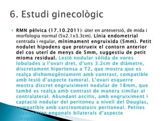 RMN pèlvica (17.10.2011 ): úter en anteversió, de mida i morfologia normal (5x2.1x3.3cm).  Línia endometrial  centrada i regular,  mínimament engruixida (5mm). Petit nodulet hipodens que protrueix el contorn anterior del cos uterí de menys de 5mm, suggestiu de petit mioma residual.  Lesió nodular sòlida de vores lobulades a l’ovari dret, d’uns 3.2cm de diàmetre, discretament hipertensa a T2, que mostra que es realça dishomogèniament amb contrast, compatible amb lesió d’aspecte tumoral. L’ovari esquerre mostra discret engruiximent nodular de 18mm, que també es realça amb contrast de manera similar al contralateral. Abundant ascitis, amb engruiximent i captació nodular del peritoneu a nivell del Douglas, compatible amb carcinomatosis peritoneal. Petites adenopaties engonals bilaterals d’aspecte inespecífic.   