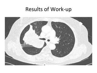Results of Work-up 