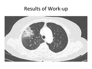 Results of Work-up 