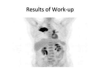 Results of Work-up 
