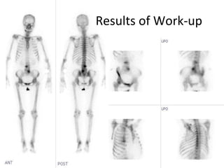 Results of Work-up 