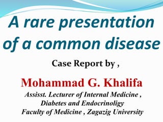A rare presentation
of a common disease
Case Report by ,
Mohammad G. Khalifa
Assisst. Lecturer of Internal Medicine ,
Diabetes and Endocrinoligy
Faculty of Medicine , Zagazig University
 