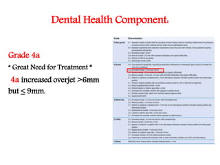 Dental Health Component:
Grade 4a
“ Great Need for Treatment “
4a increased overjet >6mm
but ≤ 9mm.
 