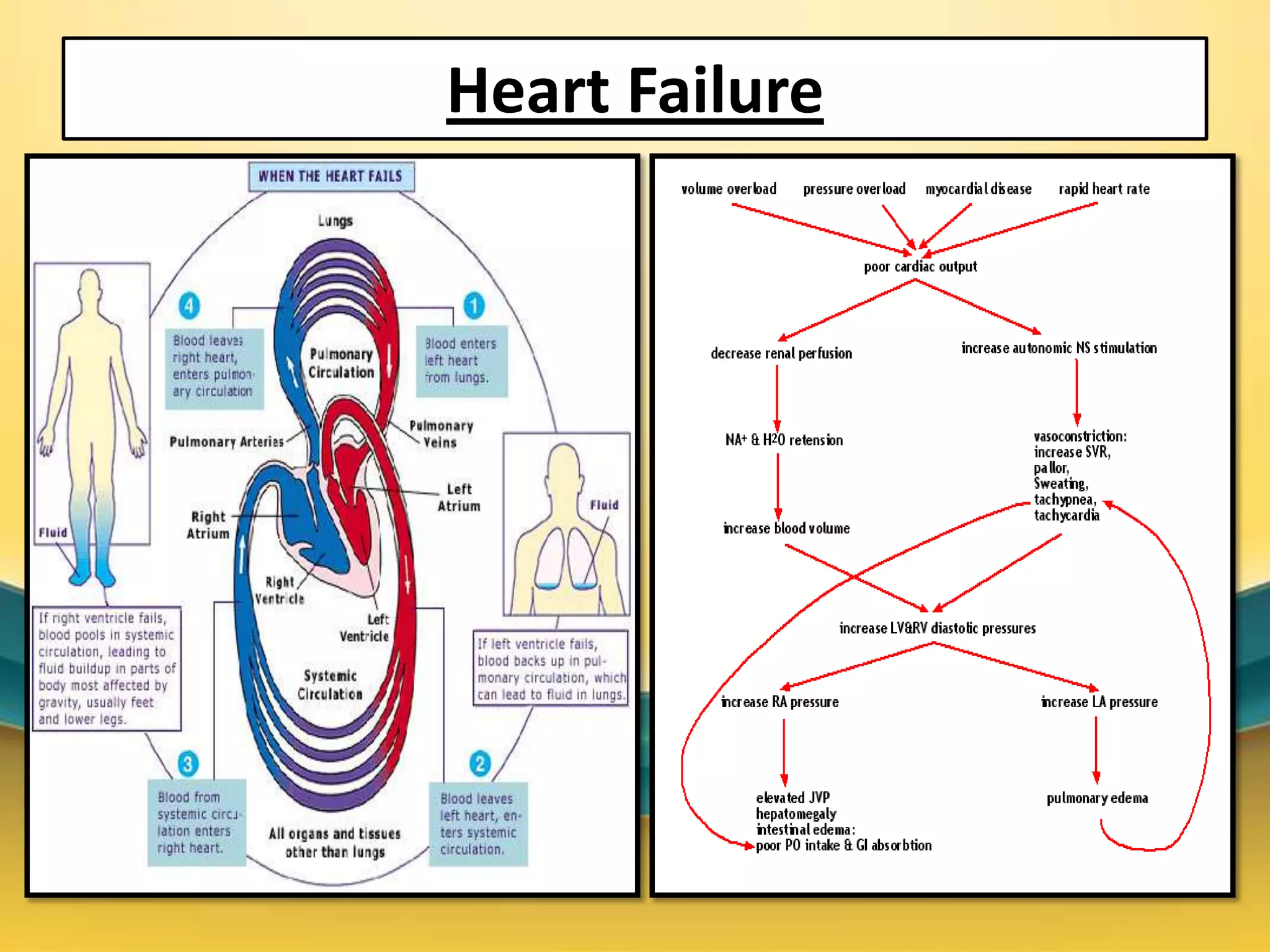 Case on heart failure (hypertrophic cardiomyopathy) | PPTX