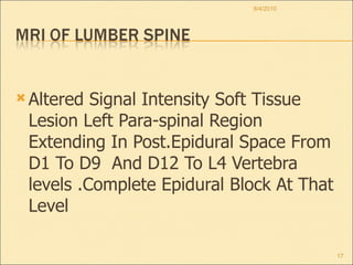 Altered Signal Intensity Soft Tissue Lesion Left Para-spinal Region Extending In Post.Epidural Space From D1 To D9  And D12 To L4 Vertebra levels .Complete Epidural Block At That Level 8/4/2010 