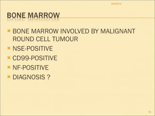 BONE MARROW INVOLVED BY MALIGNANT ROUND CELL TUMOUR NSE-POSITIVE CD99-POSITIVE NF-POSITIVE DIAGNOSIS ? 8/4/2010 