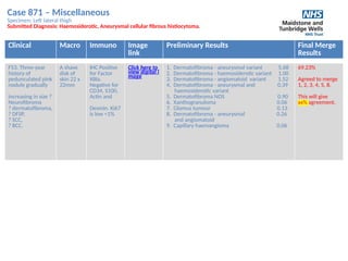 Case 871 – Miscellaneous
Specimen: Left lateral thigh
Submitted Diagnosis: Haemosiderotic, Aneurysmal cellular fibrous histiocytoma.
Clinical Macro Immuno Image
link
Preliminary Results Final Merge
Results
F53. Three-year
history of
pedunculated pink
nodule gradually
increasing in size ?
Neurofibroma
? dermatofibroma,
? DFSP,
? SCC,
? BCC.
A shave
disk of
skin 22 x
22mm
IHC Positive
for Factor
XIIIa.
Negative for
CD34, S100,
Actin and
Desmin. Ki67
is low <1%
Click here to
view digital i
mage
1. Dermatofibroma - aneurysmal variant 5.68
2. Dermatofibroma - haemosiderotic variant 1.00
3. Dermatofibroma - angiomatoid variant 1.52
4. Dermatofibroma - aneurysmal and 0.39
haemosiderotic variant
5. Dermatofibroma NOS 0.90
6. Xanthogranuloma 0.06
7. Glomus tumour 0.13
8. Dermatofibroma - aneurysmal 0.26
and angiomatoid
9. Capillary haemangioma 0.06
69.23%
Agreed to merge
1, 2, 3, 4, 5, 8.
This will give
xx% agreement.
 