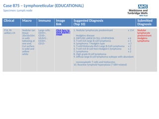 Case 875 – Lymphoreticular (EDUCATIONAL)
Specimen: Lymph node
Clinical Macro Immuno Image
link
Suggested Diagnosis
(Top 10)
Submitted
Diagnosis
F54. Rt
axillary LN
Nodular tan
tissue
20x10x10m
m with
tattooing at
one end.
Cut surface
is solid and
yellow
white
Large cells:
CD45+,
CD30-,
MUM1-,
CD20+,
CD15-
Click here to
view digital i
mage
1. Nodular lymphocyte predominant x 114
Hodgkins disease
2. DIFFUSE LARGE B-CELL LYMPHOMA x 6
3. T-cell rich large B-cell lymphoma x 3
4. Lymphoma ? Hodgkin type x 2
5. T-cell/Histiocyte-Rich Large B-Cell Lymphoma x 2
6. T-cell rich B-cell Non-Hodgkin’s lymphoma x 2
7. Lymphoma x 2
8. High grade B cell lymphoma
9. Diffuse large B cell lymphoma subtype with abundant
nonneoplastic T cells and histiocytes
10. Reactive lymphoid hyperplasia (? EBV-related)
Nodular
lymphocyte
predominant
Hodgkins
Lymphoma
 