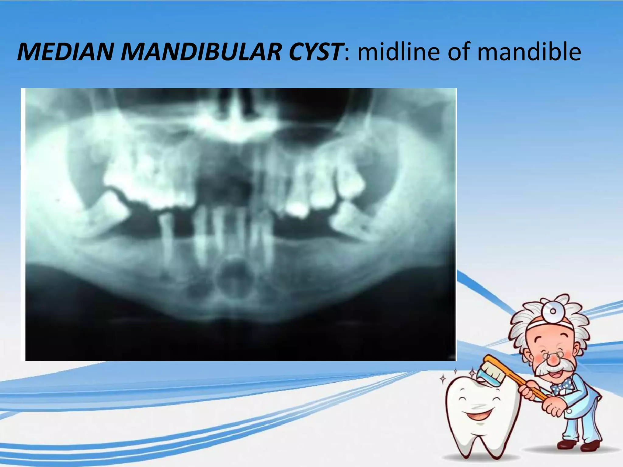DENTAL CASE HISTORY DEMOGRAPHIC DATA CHIEF COMPLAINT HOPI PPTX dental-case-history-demographic-data-chief-complaint-hopi-pptx