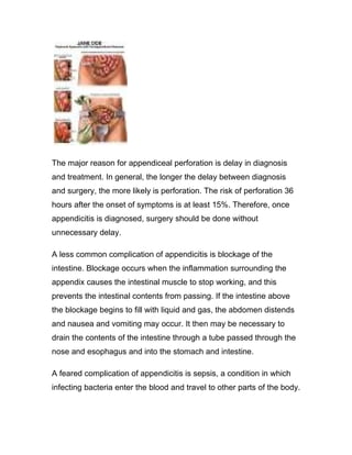The major reason for appendiceal perforation is delay in diagnosis
and treatment. In general, the longer the delay between diagnosis
and surgery, the more likely is perforation. The risk of perforation 36
hours after the onset of symptoms is at least 15%. Therefore, once
appendicitis is diagnosed, surgery should be done without
unnecessary delay.

A less common complication of appendicitis is blockage of the
intestine. Blockage occurs when the inflammation surrounding the
appendix causes the intestinal muscle to stop working, and this
prevents the intestinal contents from passing. If the intestine above
the blockage begins to fill with liquid and gas, the abdomen distends
and nausea and vomiting may occur. It then may be necessary to
drain the contents of the intestine through a tube passed through the
nose and esophagus and into the stomach and intestine.

A feared complication of appendicitis is sepsis, a condition in which
infecting bacteria enter the blood and travel to other parts of the body.
 