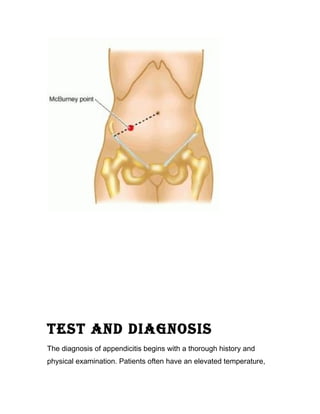 TEST AND DIAGNOSIS
The diagnosis of appendicitis begins with a thorough history and
physical examination. Patients often have an elevated temperature,
 