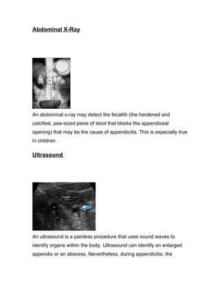 Abdominal X-Ray




An abdominal x-ray may detect the fecalith (the hardened and
calcified, pea-sized piece of stool that blocks the appendiceal
opening) that may be the cause of appendicitis. This is especially true
in children.

Ultrasound




An ultrasound is a painless procedure that uses sound waves to
identify organs within the body. Ultrasound can identify an enlarged
appendix or an abscess. Nevertheless, during appendicitis, the
 