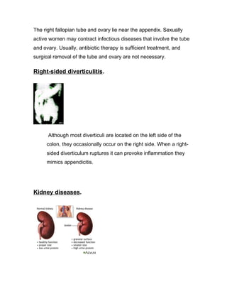 The right fallopian tube and ovary lie near the appendix. Sexually
active women may contract infectious diseases that involve the tube
and ovary. Usually, antibiotic therapy is sufficient treatment, and
surgical removal of the tube and ovary are not necessary.

Right-sided diverticulitis.




      Although most diverticuli are located on the left side of the
      colon, they occasionally occur on the right side. When a right-
      sided diverticulum ruptures it can provoke inflammation they
      mimics appendicitis.




Kidney diseases.
 