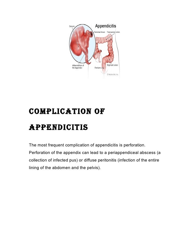 Nursing case study Appendectomy