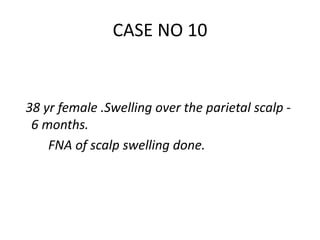 38 yr female .Swelling over the parietal scalp -
6 months.
FNA of scalp swelling done.
CASE NO 10
 