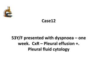 Case12
53Y/F presented with dyspnoea – one
week. CxR – Pleural effusion +.
Pleural fluid cytology
 