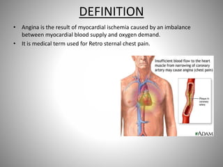 Case presentation on angina pectoris | PPTX