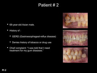 Patient # 2
• 68-year-old Asian male.
• History of :
• GERD (Gastroesophageal-reflux disease)
• Denies history of tobacco or drug use
• Chief complaint: “I was told that I need
treatment for my gum diseases.”
Pt 2
 