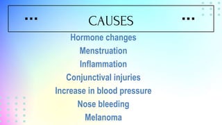 Case study haemolacria_SSH | PPTX
