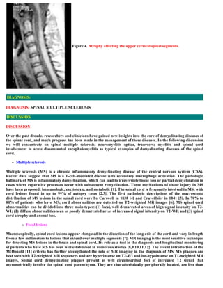 Case record...Spinal multiple sclerosis