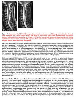 Case record...Spinal multiple sclerosis