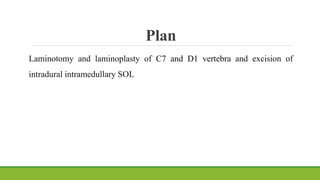 Plan
Laminotomy and laminoplasty of C7 and D1 vertebra and excision of
intradural intramedullary SOL
 