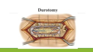 Durotomy
 