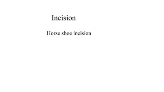 Incision
Horse shoe incision
 