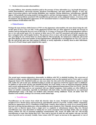 Case record...Neurofibromatosis type 1 | PDF
