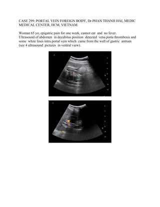 CASE 299: PORTAL VEIN FOREIGN BODY, Dr PHAN THANH HẢI, MEDIC
MEDICAL CENTER, HCM, VIETNAM.
Woman 65 yo, epigatric pain for one week, cannot eat and no fever.
Ultrasound of abdomen in decubitus position detected vena porta thrombosis and
some white lines intra portal vein which came from the wall of gastric antrum
(see 4 ultrasound pictures in ventral view).
 