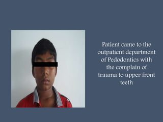 Patient came to the
outpatient department
of Pedodontics with
the complain of
trauma to upper front
teeth
 