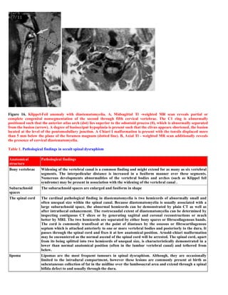 Case record... Spinal dysraphism