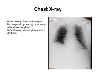 Chest X-ray
There is no significant cardiomegaly.
The lung markings are slightly increased
in both lower lung fields.
Bilateral costophrenic angles are clearly
identified.
 