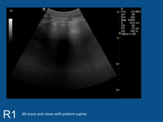 R1 All scans and views with patient supine 
 