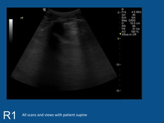 R1 All scans and views with patient supine 
 