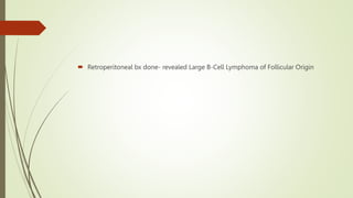  Retroperitoneal bx done- revealed Large B-Cell Lymphoma of Follicular Origin
 