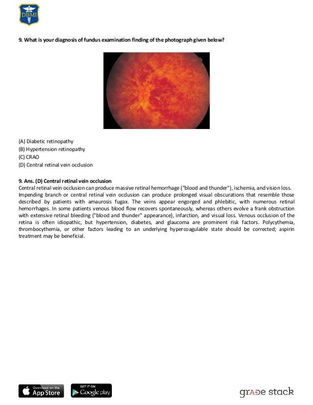 Case based Ophthalmology Guide