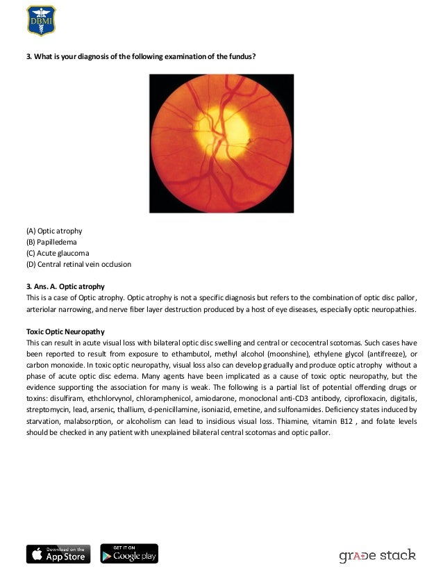 Case based Ophthalmology Guide
