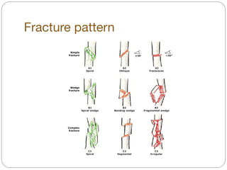 Fracture pattern
 