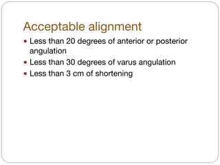 Acceptable alignment 
! Less than 20 degrees of anterior or posterior
angulation

! Less than 30 degrees of varus angulation

! Less than 3 cm of shortening
 
