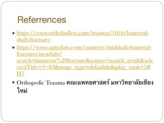 Referrences
! https://www.orthobullets.com/trauma/1016/humeral-
shaft-fractures
! https://www.uptodate.com/contents/midshaft-humeral-
fractures-in-adults?
search=humerus%20fracture&source=search_result&sele
ctedTitle=3~83&usage_type=default&display_rank=3#
H7
! Orthopedic Trauma คณะแพทยศาสตร์ มหาวิทยาลัยเชียง
ใหม่
 