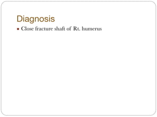 Diagnosis
! Close fracture shaft of Rt. humerus
 